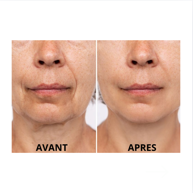 LiftPro™ SculptX - Sculpteur Visage & Cou