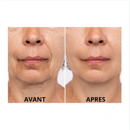 LiftPro™ SculptX - Sculpteur Visage & Cou