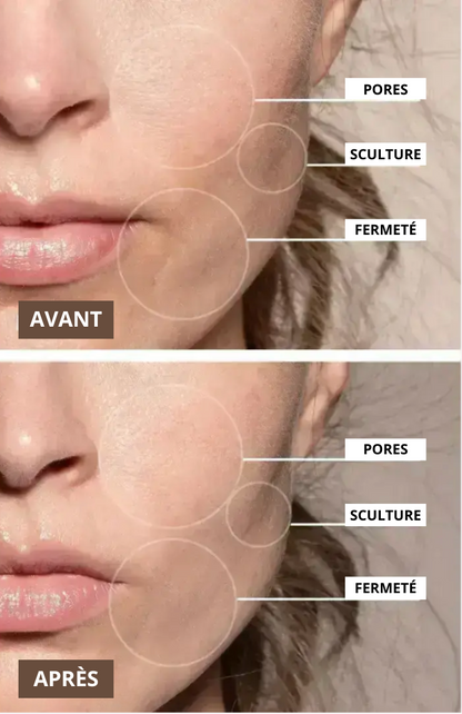 LiftPro™ SculptX - Sculpteur Visage & Cou